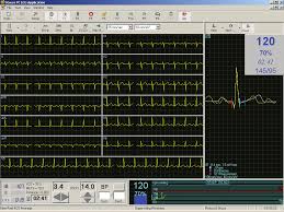 آریا طب پیشرفته – خدمات تردمیل و نرم افزار ترکمستر